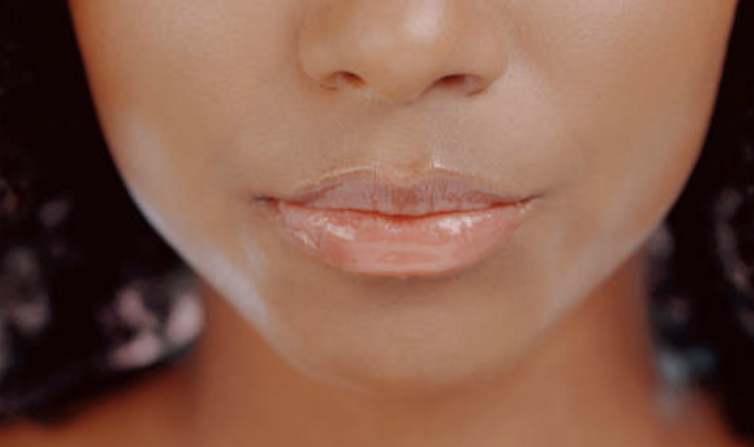 Lip Waxing_Candee Skin best in Waxing_Dallas